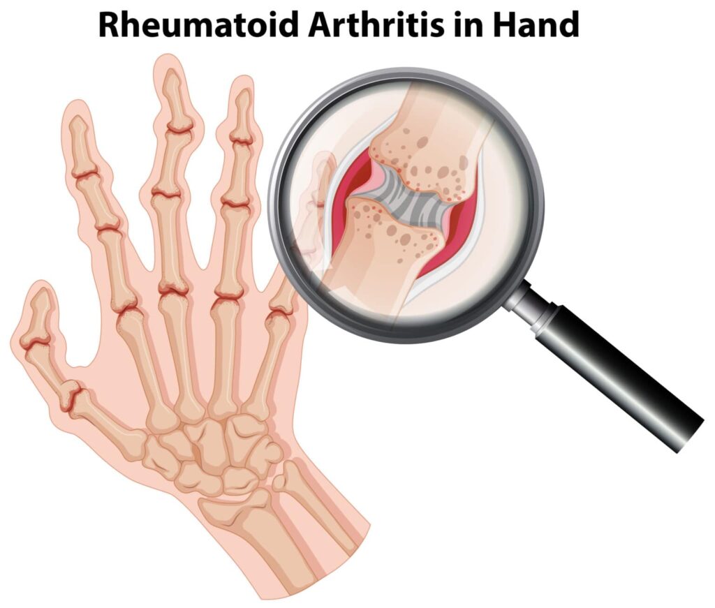 Best Rheumatologist in Aurangabad