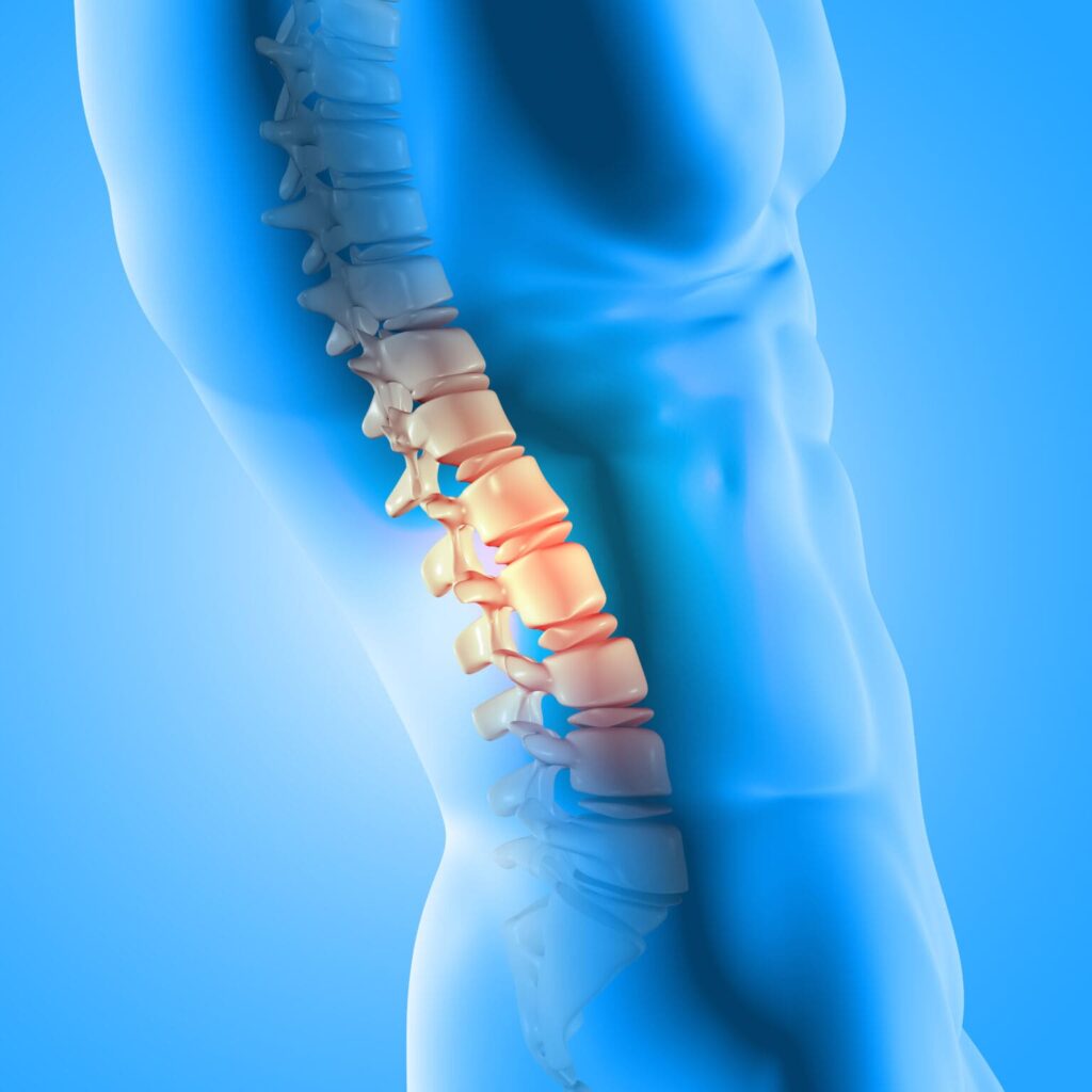 Back pain doctor in Aurangabad