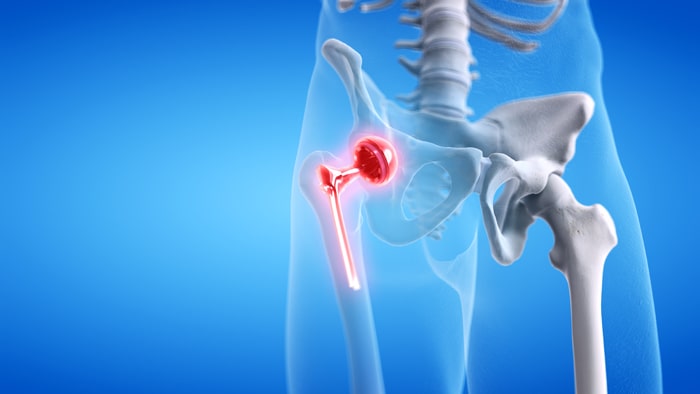 Hip Pain doctor in Aurangabad