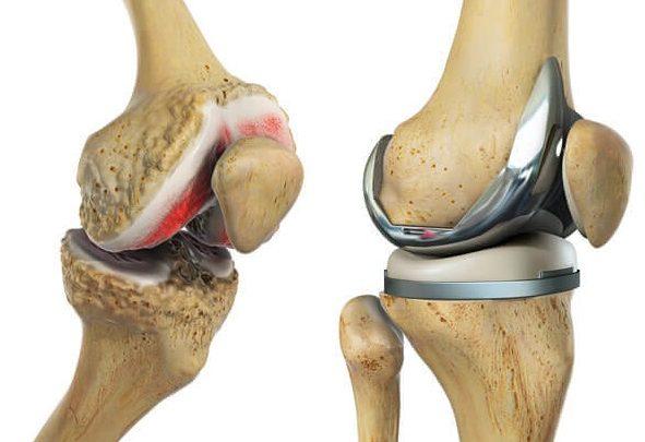 Knee Pain doctor in Aurangabad